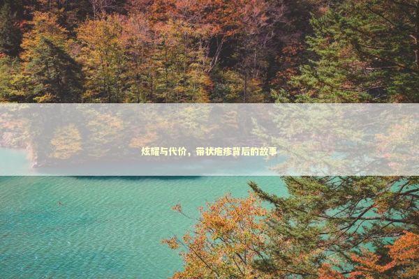 炫耀与代价，带状疱疹背后的故事